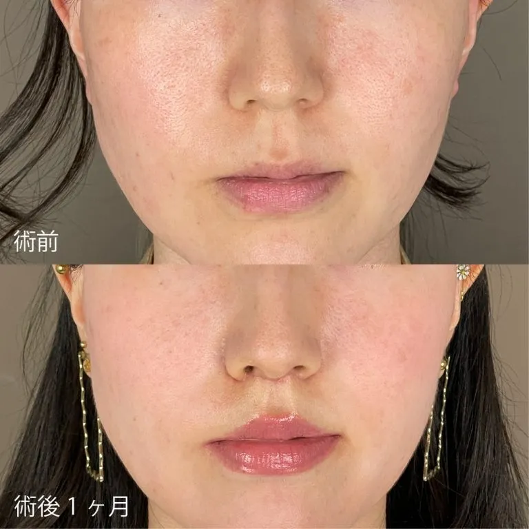 Before & After Photos