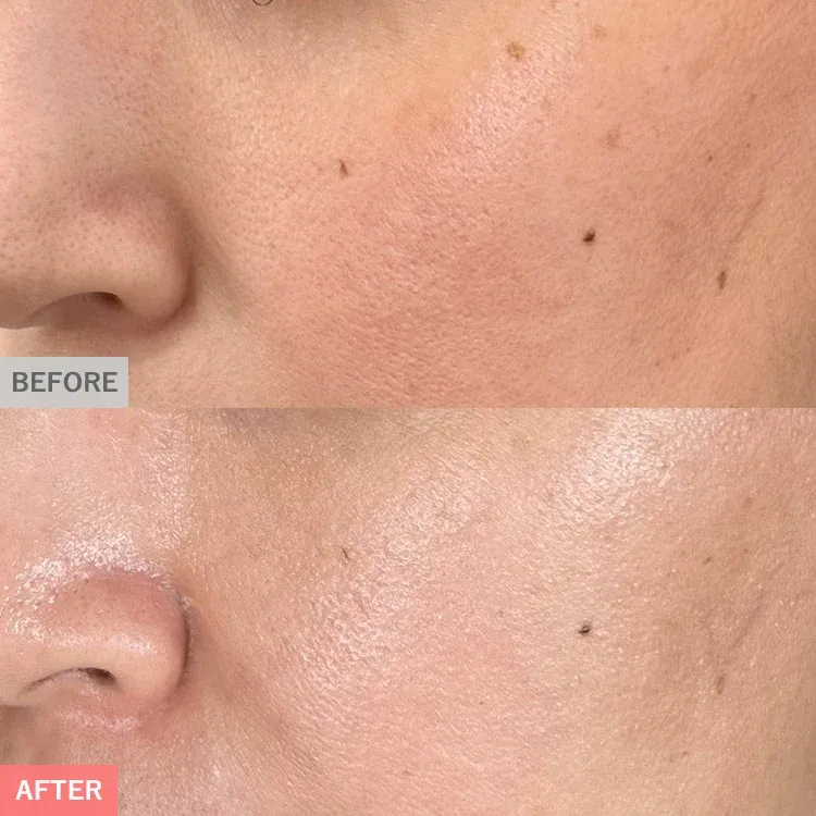Pico Toning