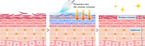 Chemical Peeling