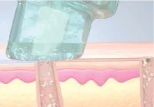 HydraFacial