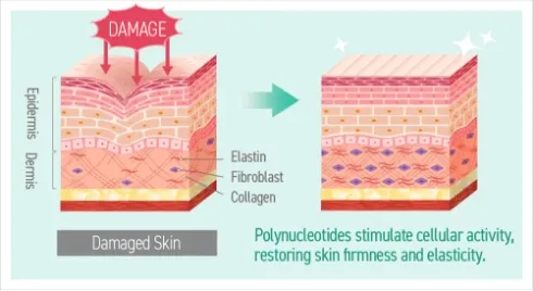 Rejuran (Salmon Injection) Image