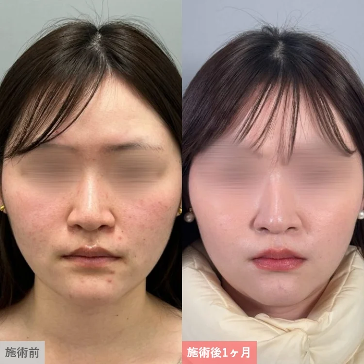 案例照片