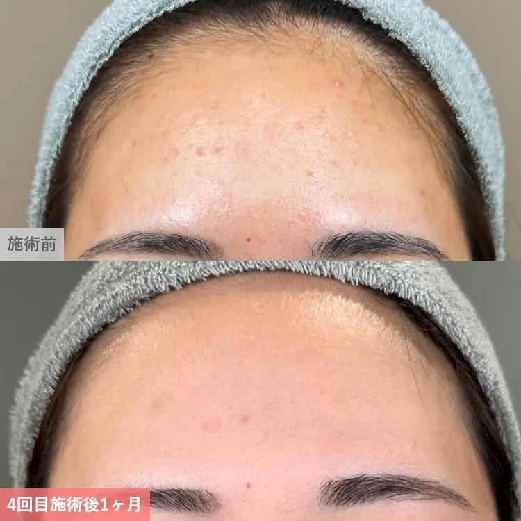 案例照片