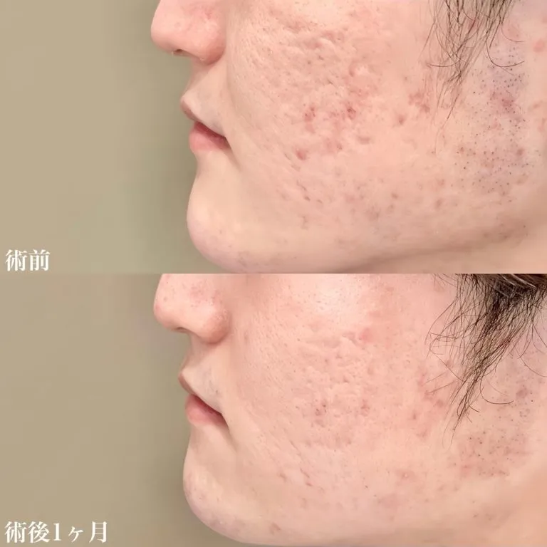 案例照片