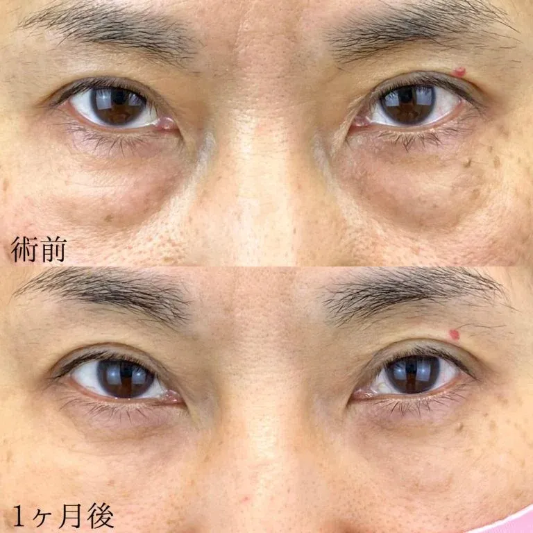 案例照片