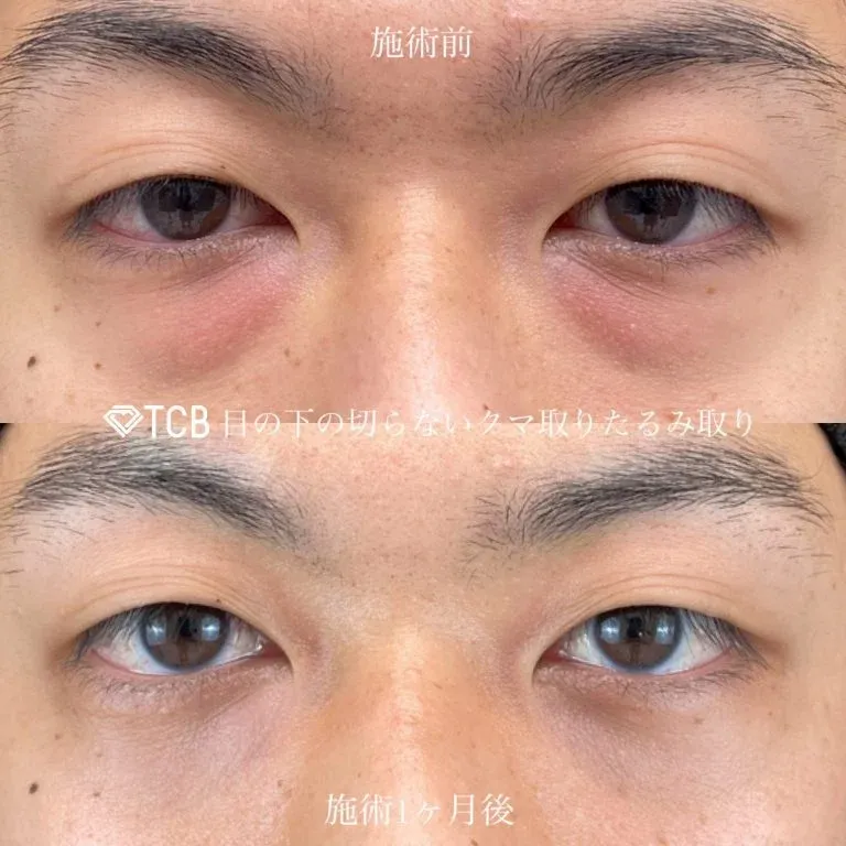案例照片