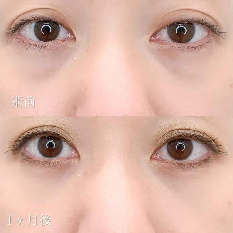 案例照片