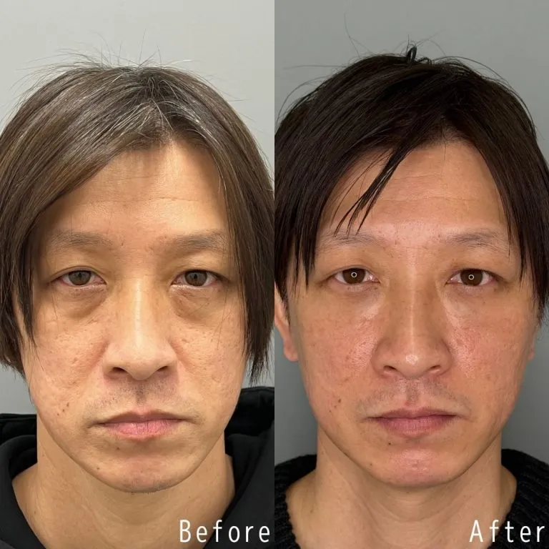 案例照片