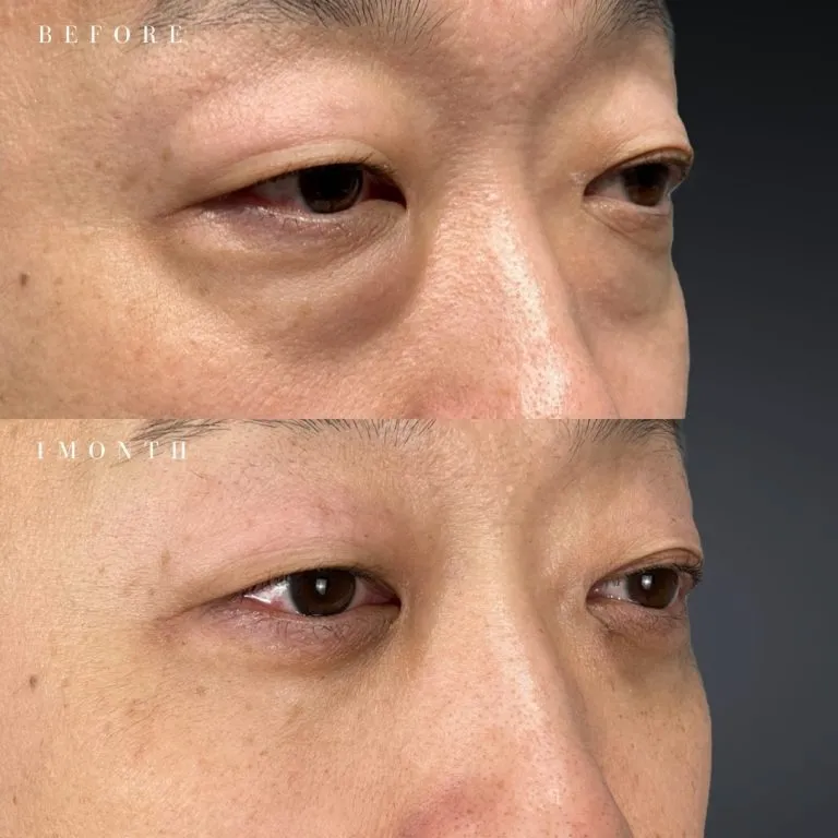 案例照片