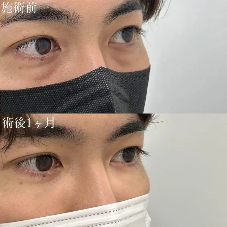 案例照片