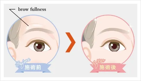 示意图
