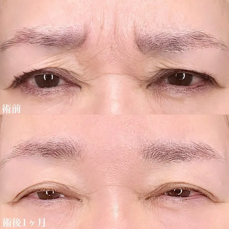 案例照片