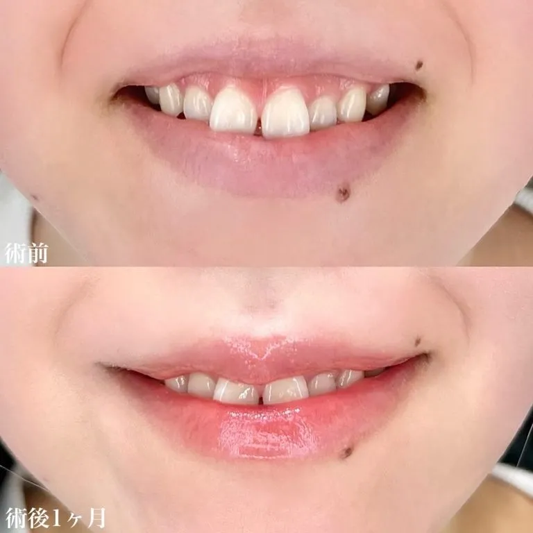 案例照片