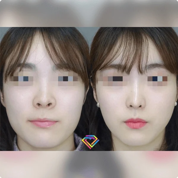 案例照片