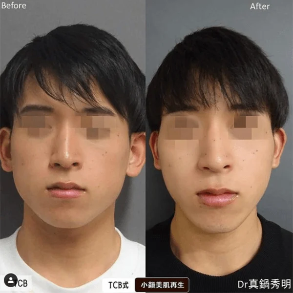 案例照片