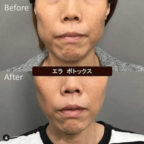 案例照片