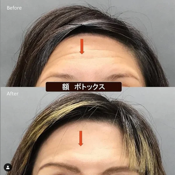 案例照片