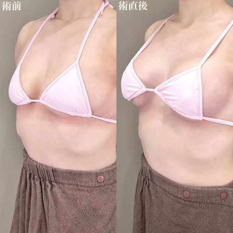 案例照片