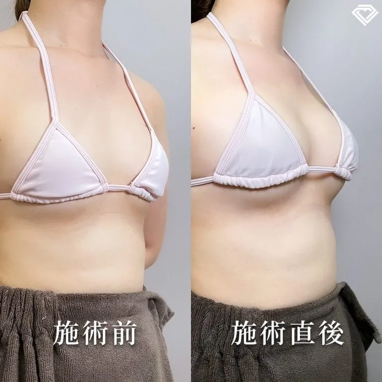 案例照片