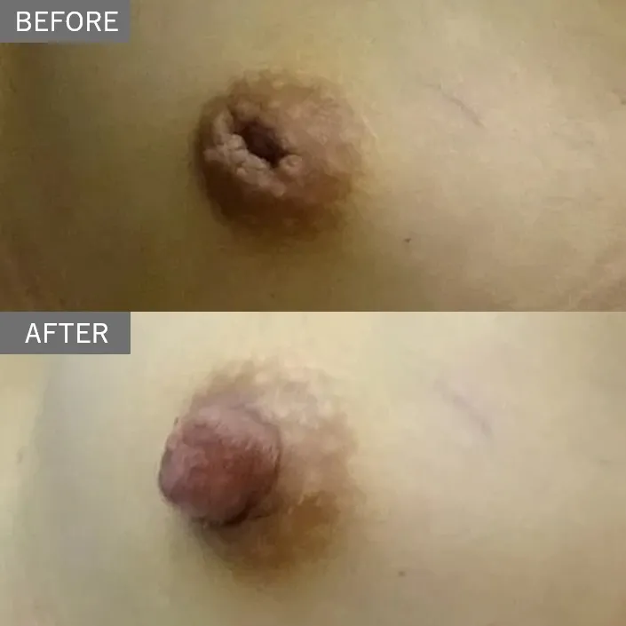 Before & After Photos