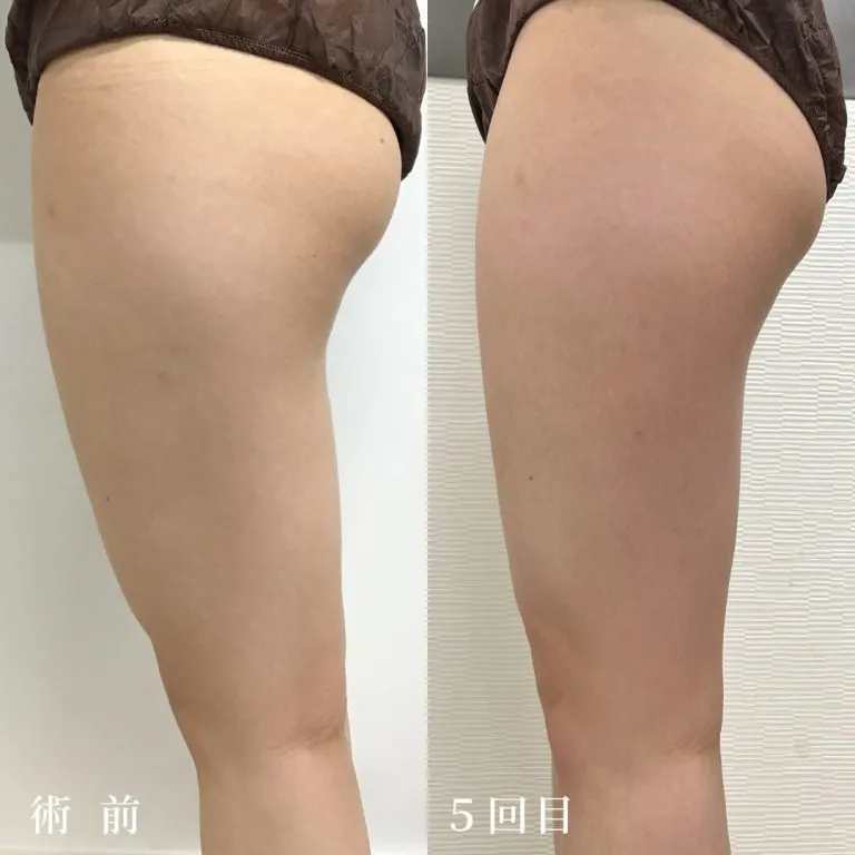 Dr.'sダイエット【医療全身ダイエット】