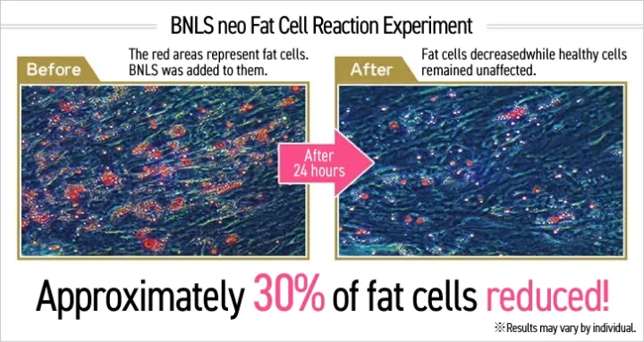 脂肪溶解效果を高めたBNLS アルティメット