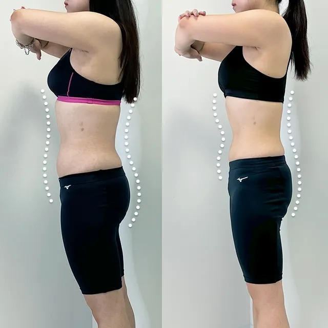 Beauty Slim Program（美体瘦身计划）案例照片