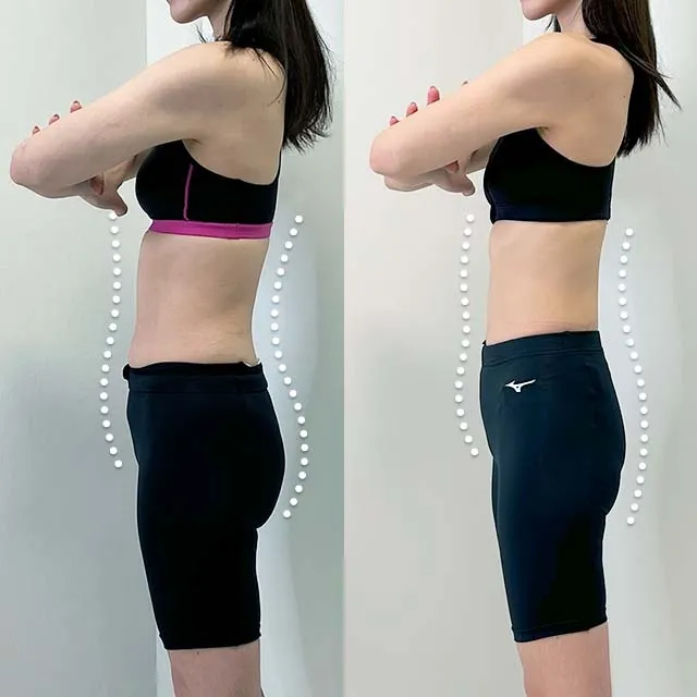 Beauty Slim Program（美体瘦身计画）案例照片