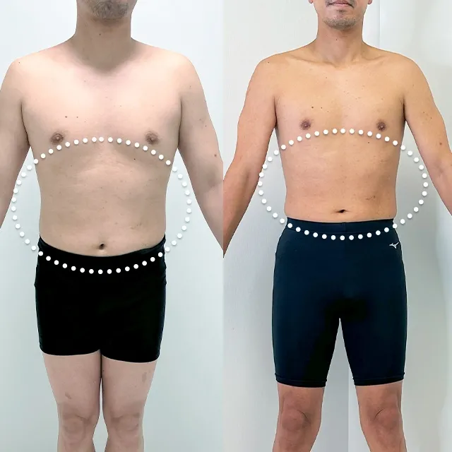 Beauty Slim Program（美体瘦身计划）案例照片