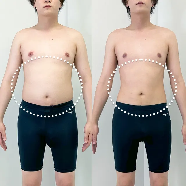 Beauty Slim Program（美体瘦身计划）案例照片