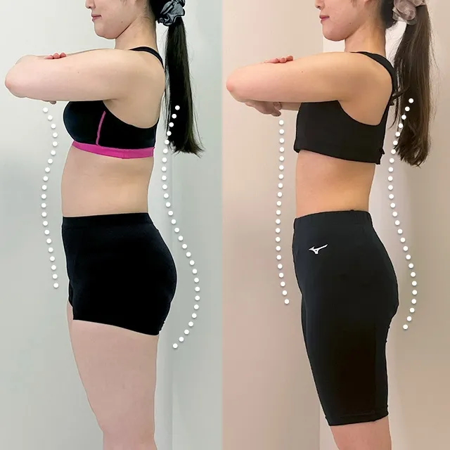 Beauty Slim Program（美体瘦身计划）案例照片