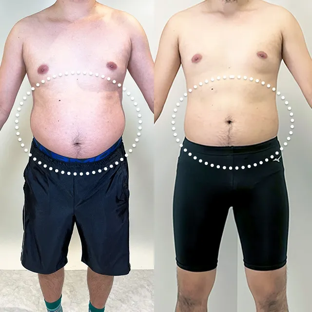 Beauty Slim Program（美体瘦身计划）案例照片