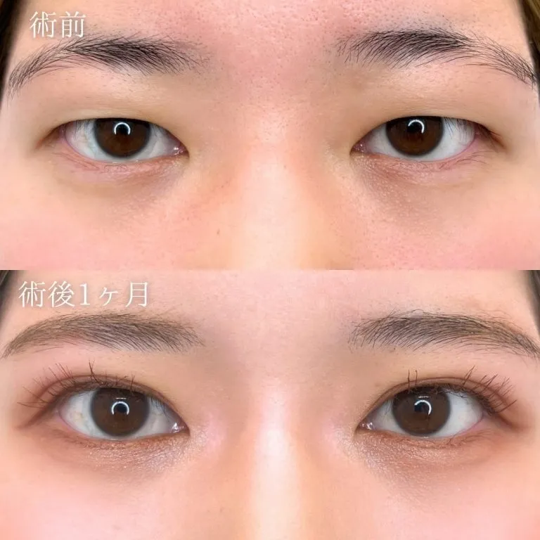 症例写真