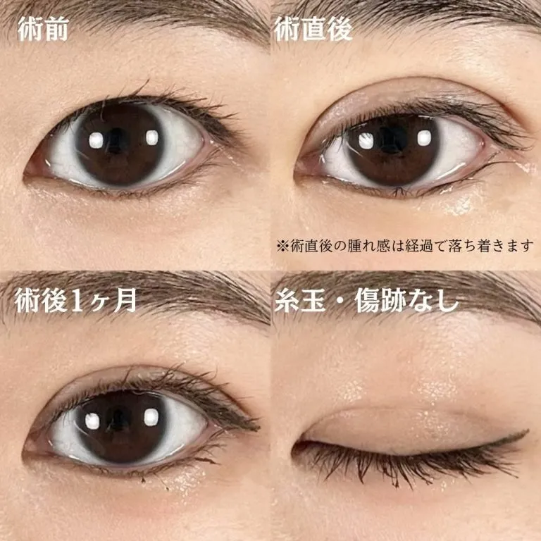 症例写真