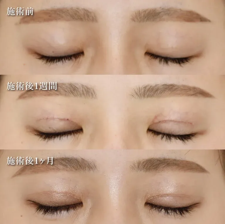 症例写真