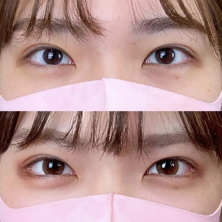 症例写真
