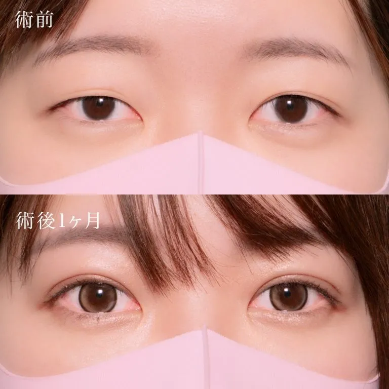 症例写真