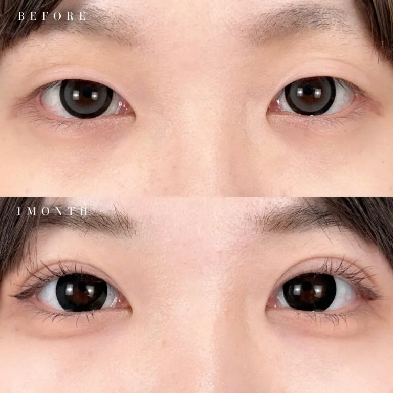症例写真