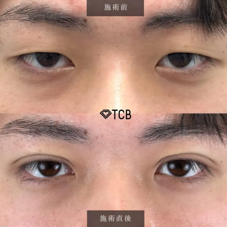 症例写真
