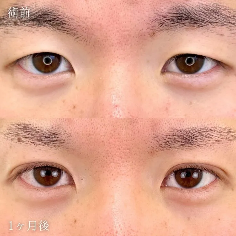 症例写真
