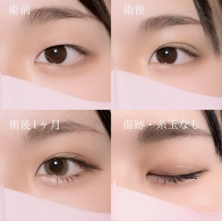 症例写真
