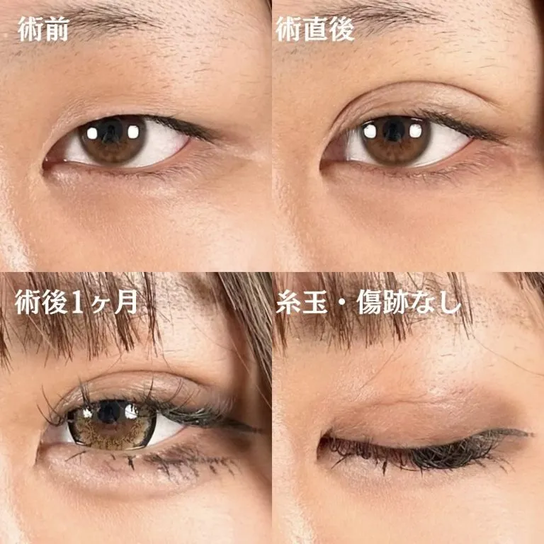 症例写真
