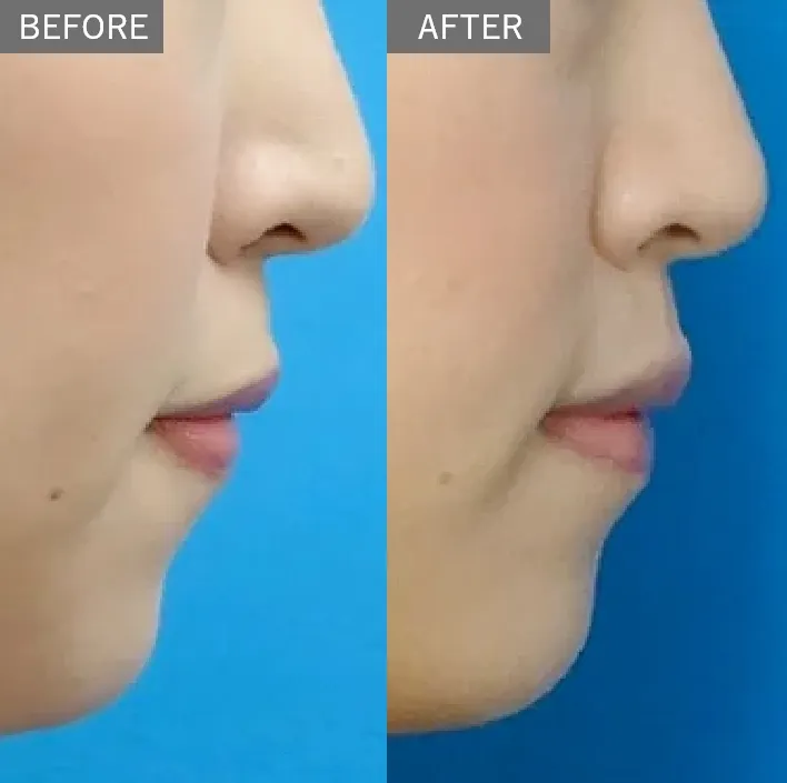 Slim Face