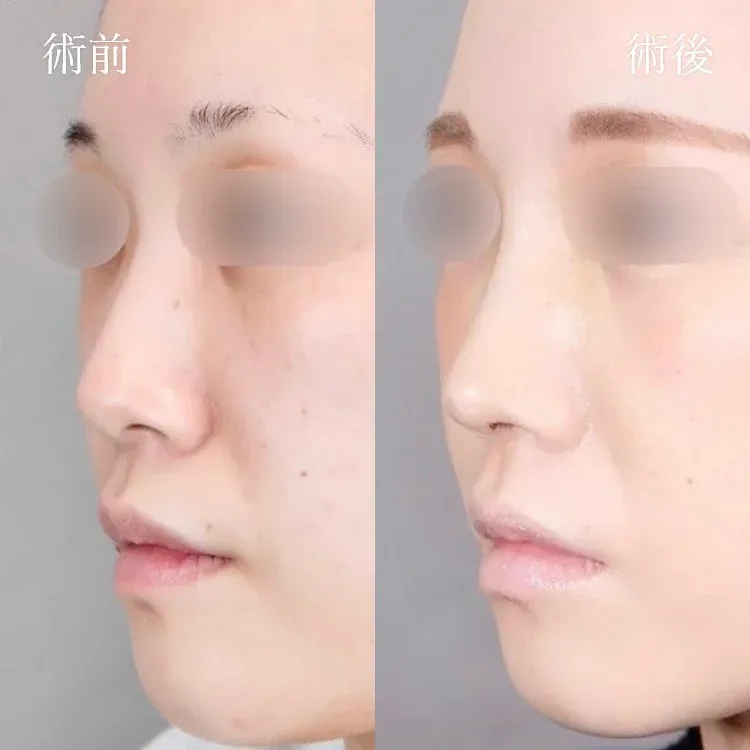 案例照片