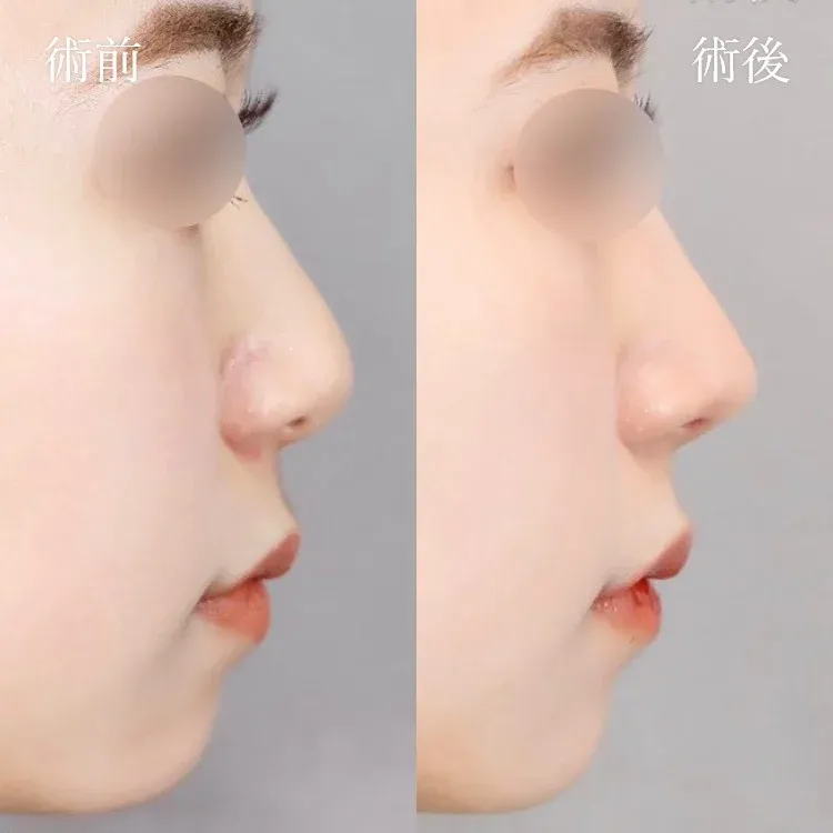 案例照片