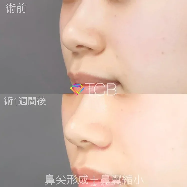 案例照片