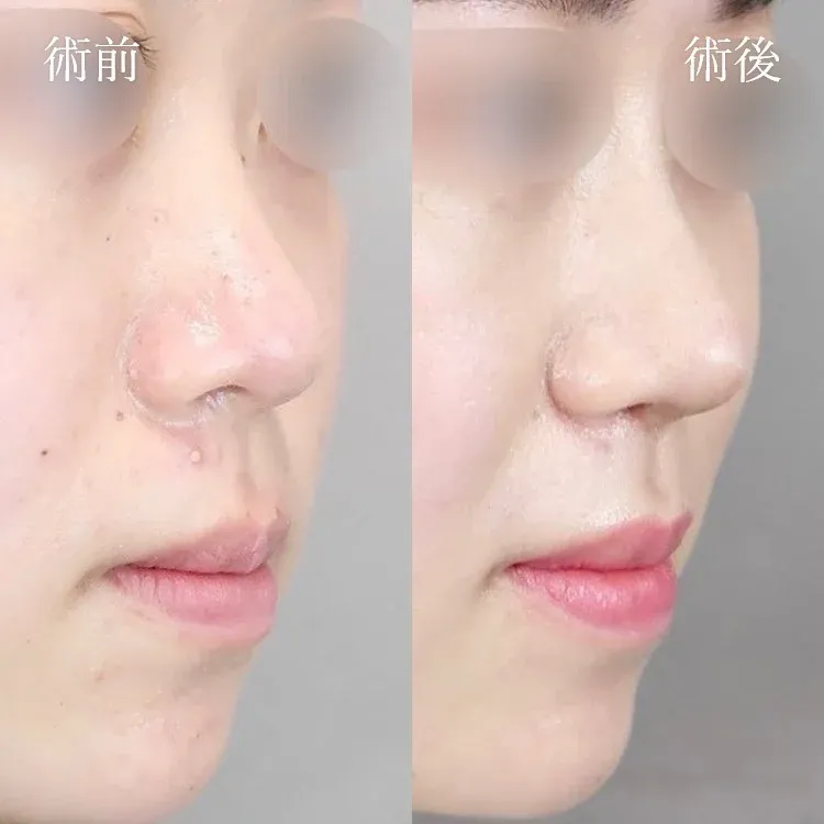 案例照片