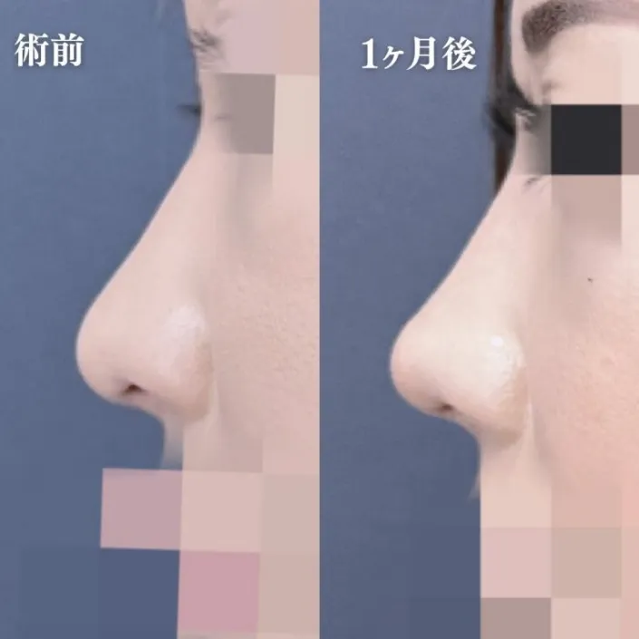 案例照片