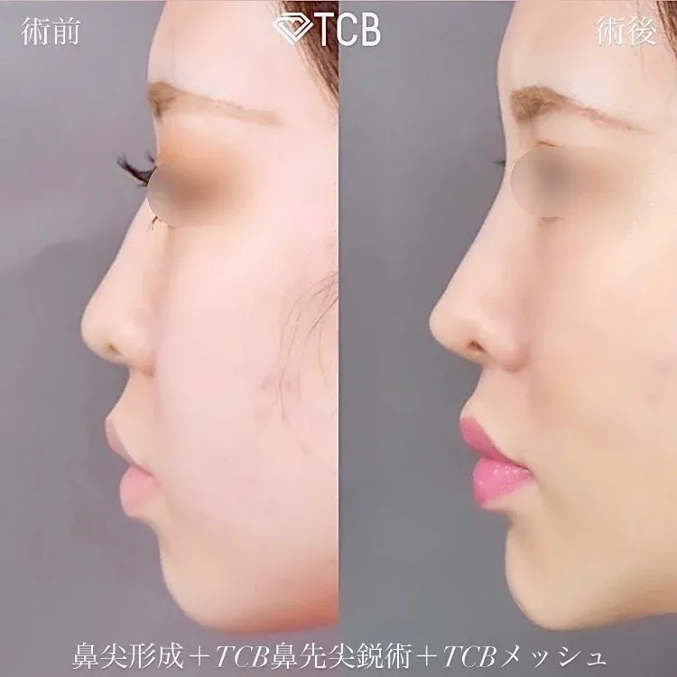 案例照片