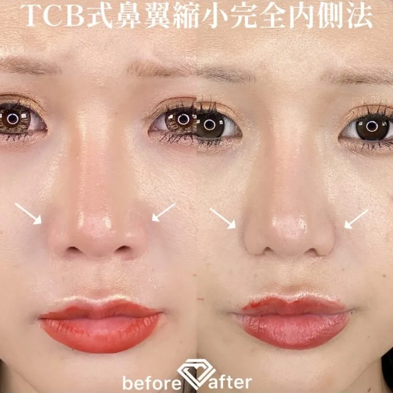 案例照片
